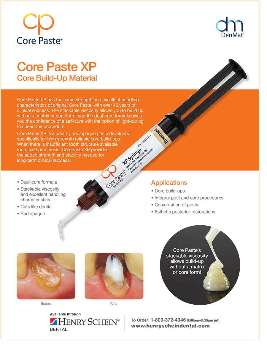 Core Paste XP